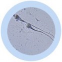 Microbi Giganti SPERMATOZOO Cellula spermatica