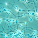Microbi Giganti SPERMATOZOO Cellula spermatica