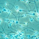 Microbi Giganti SPERMATOZOO Cellula spermatica