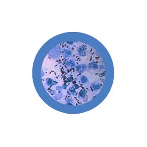Microbi Giganti SCOLO gonorrea