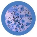 Microbi Giganti SCOLO gonorrea