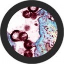 Microbi Super Giganti HIV AIDS 26 cm diametro